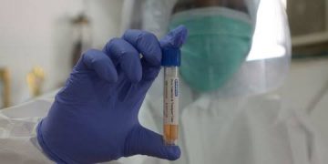 Kabupaten TTS Kembali Masuk Zona Merah Covid-19