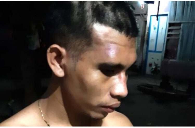 Anso Lamabelawa (22) korban penganiayaan oleh oknum anggota TNI di Lewoleba, Kabupaten Lembata / Foto Istimewa