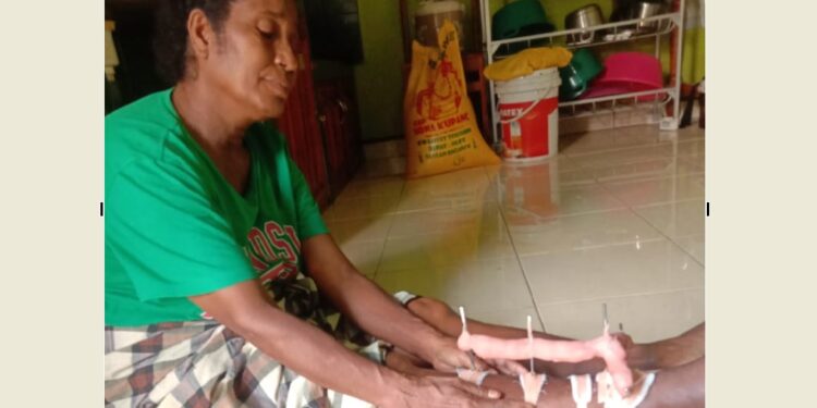 Sudah Sebulan Pen Kaki Belum Dilepas, Fatima Minta Perhatian Pemda Lembata