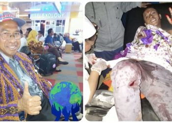 Alami Luka Serius, Pastor SVD Asal Nagekeo NTT Diserang di Madagaskar. Ini Kronologinya!