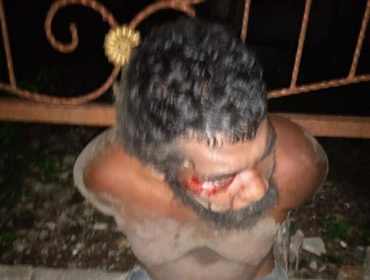 Yosef Kapaso Bala Lata Ledjap, ODGJ di Lembata yang diduga dianiaya oknum polisi anggota Polres Lembata/ Foto : BentaraNet